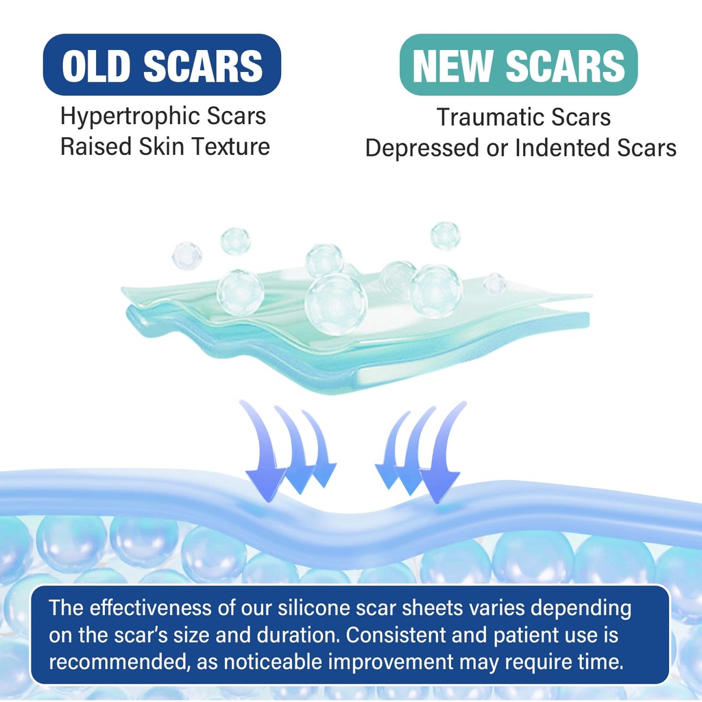 silicone-scar-sheets-silicone-scar-tape--5.jpg