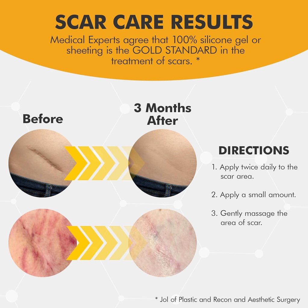 pure-scar-care-medical-grade-silicone-ge-3.jpg
