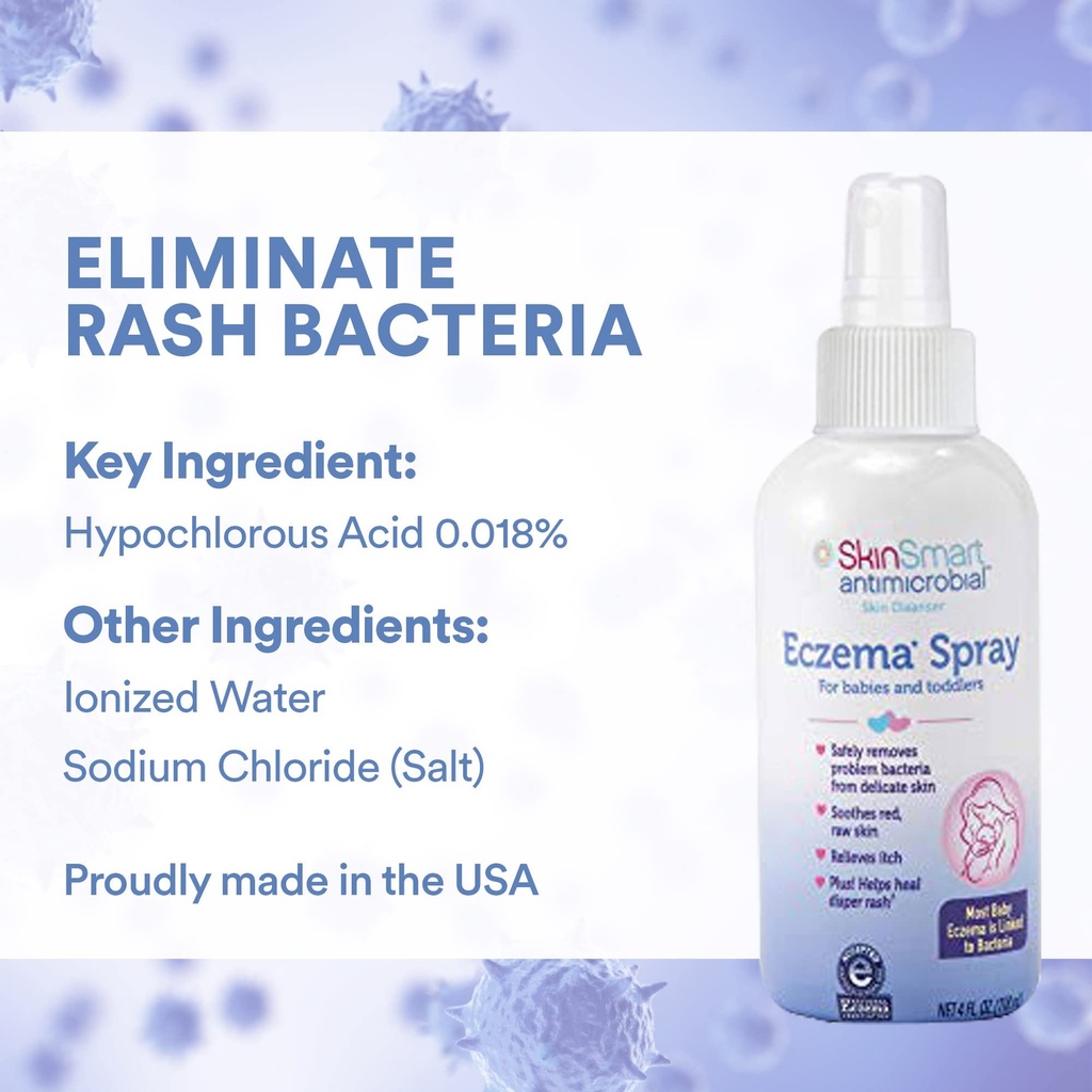 skinsmart-eczema-spray-for-babies-and-to-5.jpg