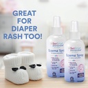 skinsmart-eczema-spray-for-babies-and-to-4.jpg