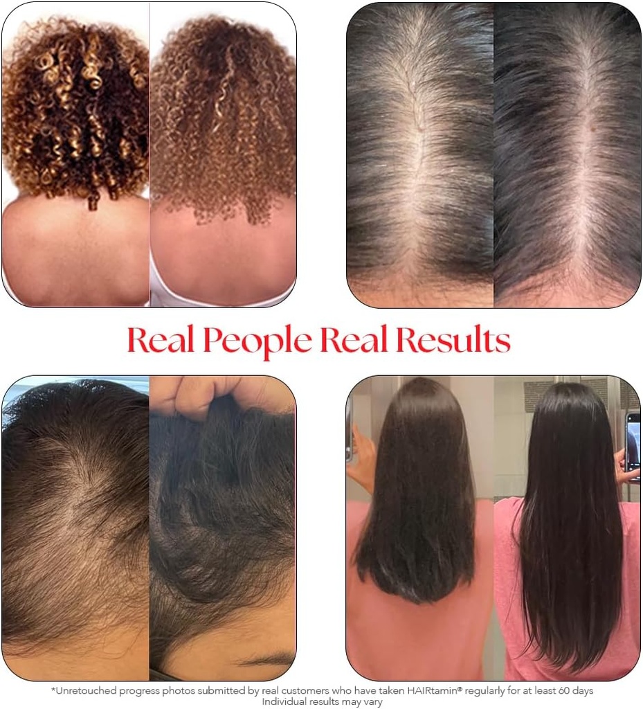 hairtamin-advanced-vegan-biotin-suppleme-4.jpg