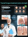 2026-upgrade-toenail-fungus-treatment-ma-3.jpg