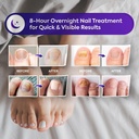 natural-vine-fungal-nail-patches-max-str-5.jpg