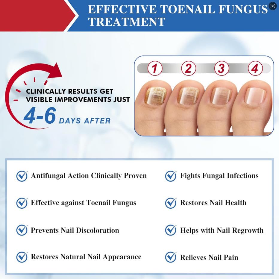 fungal-nail-patches-60-pcs-upgraded-toe--6.jpg