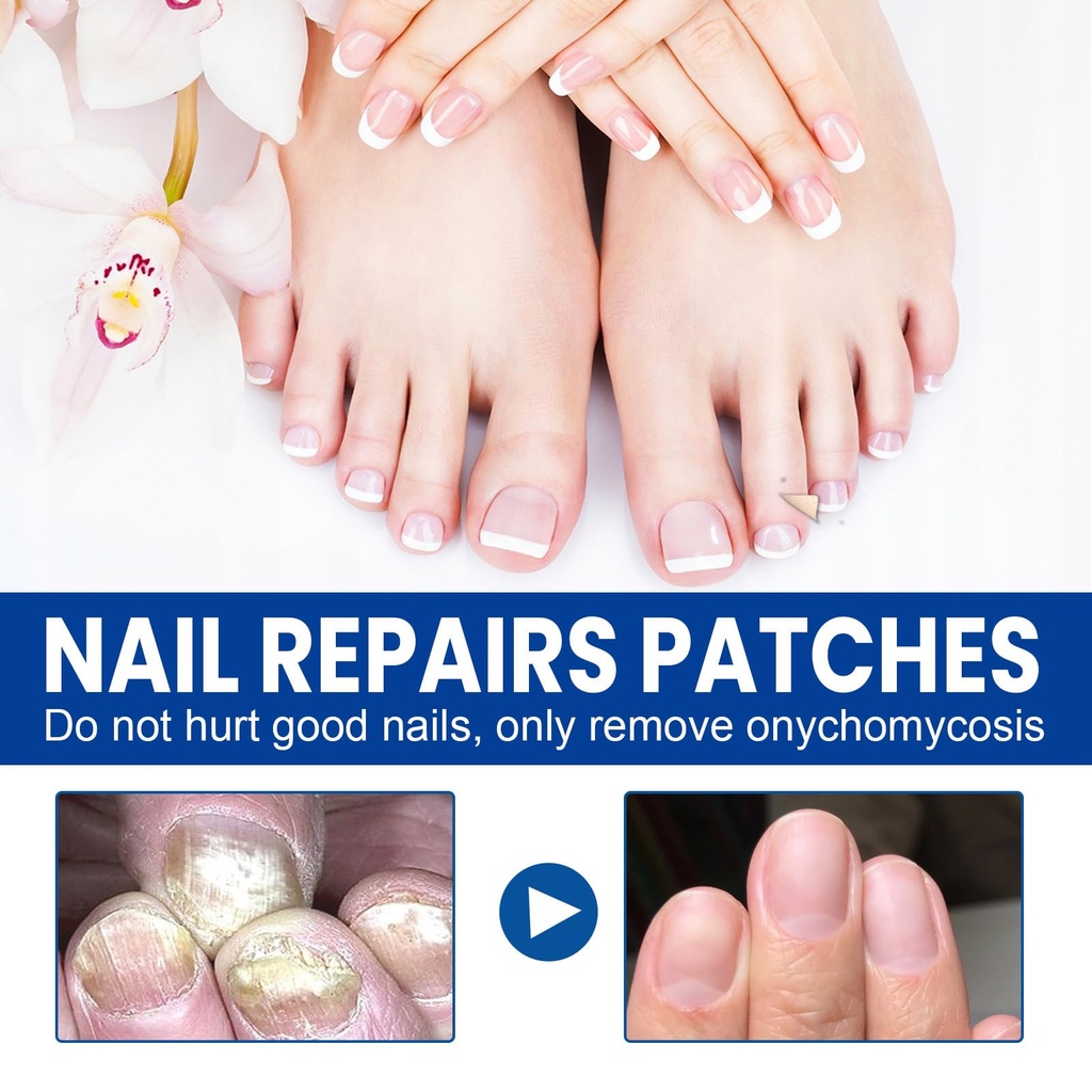 fungal-nail-patches-60-pcs-upgraded-toe--4.jpg