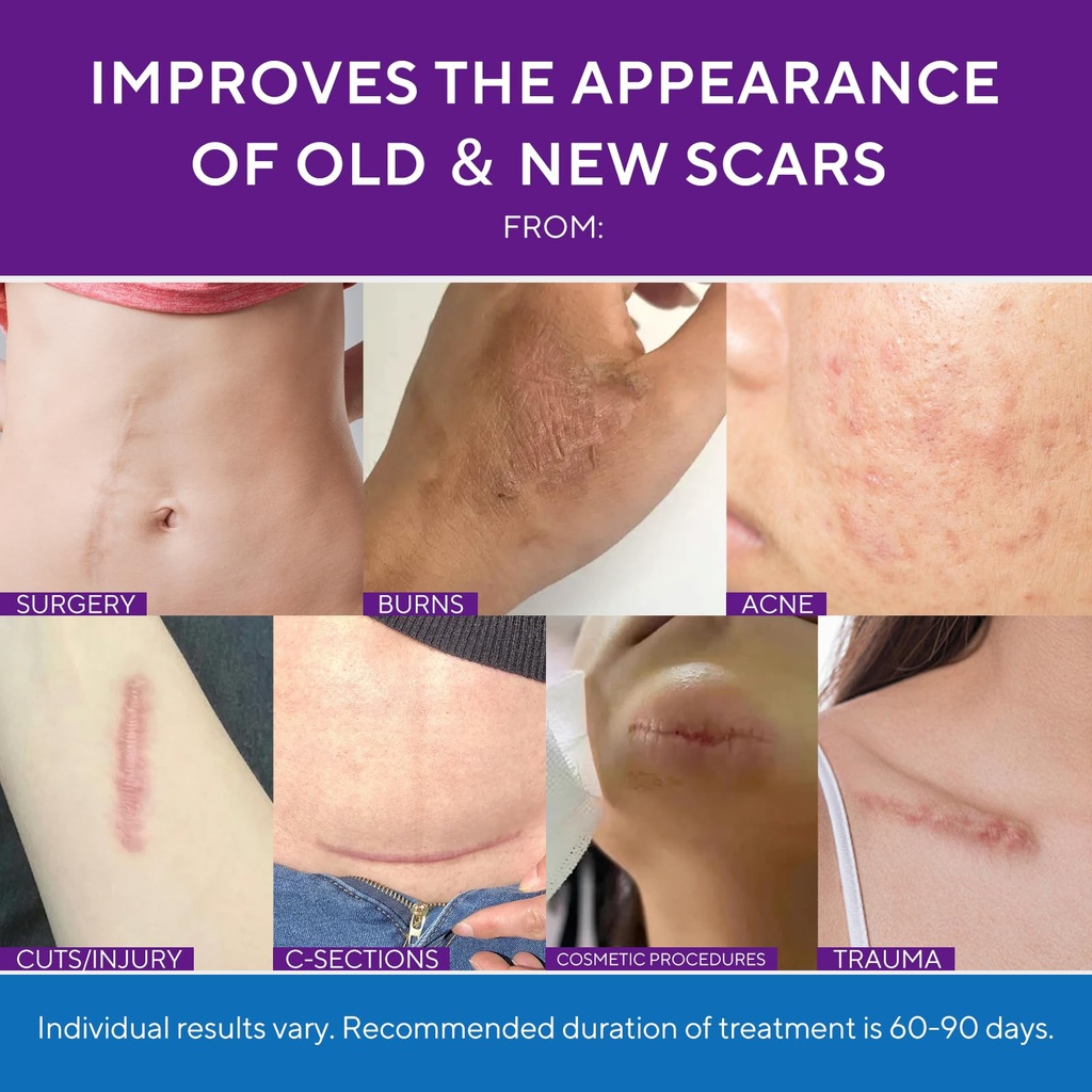 advanced-silicone-scar-gel-scar-cream-fo-71rooJosJwL.jpg