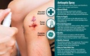 globe-antiseptic-spray-benzalkonium-chlo-81PfswOpv0L.jpg