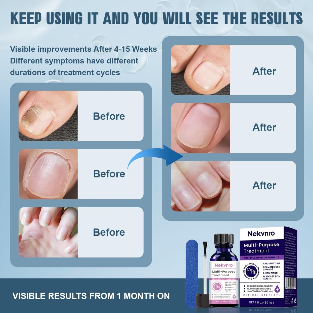 extra-strength-nail-fungus-treatment---e-5.jpg