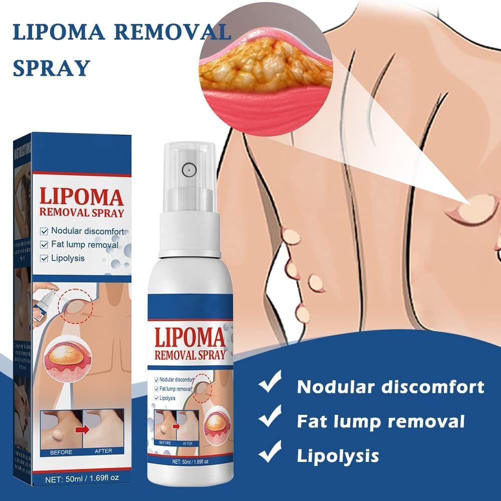 lipoma-reduction-spray-advanced-herbal-f-61V+1v6bfIL.jpg