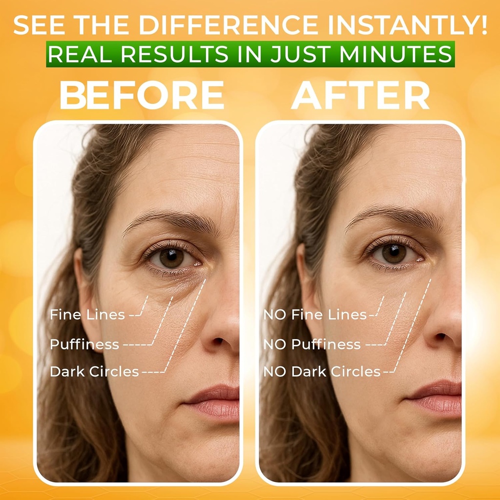 puffy-eye-treatment-instant-results-natu-4.jpg
