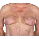 ikasus-powerful-gynecomastia-tightening--2.jpg