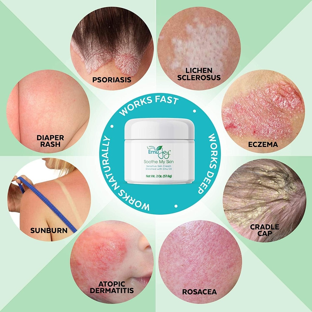soothe-my-skin-cream-for-sensitive-skin--2.jpg