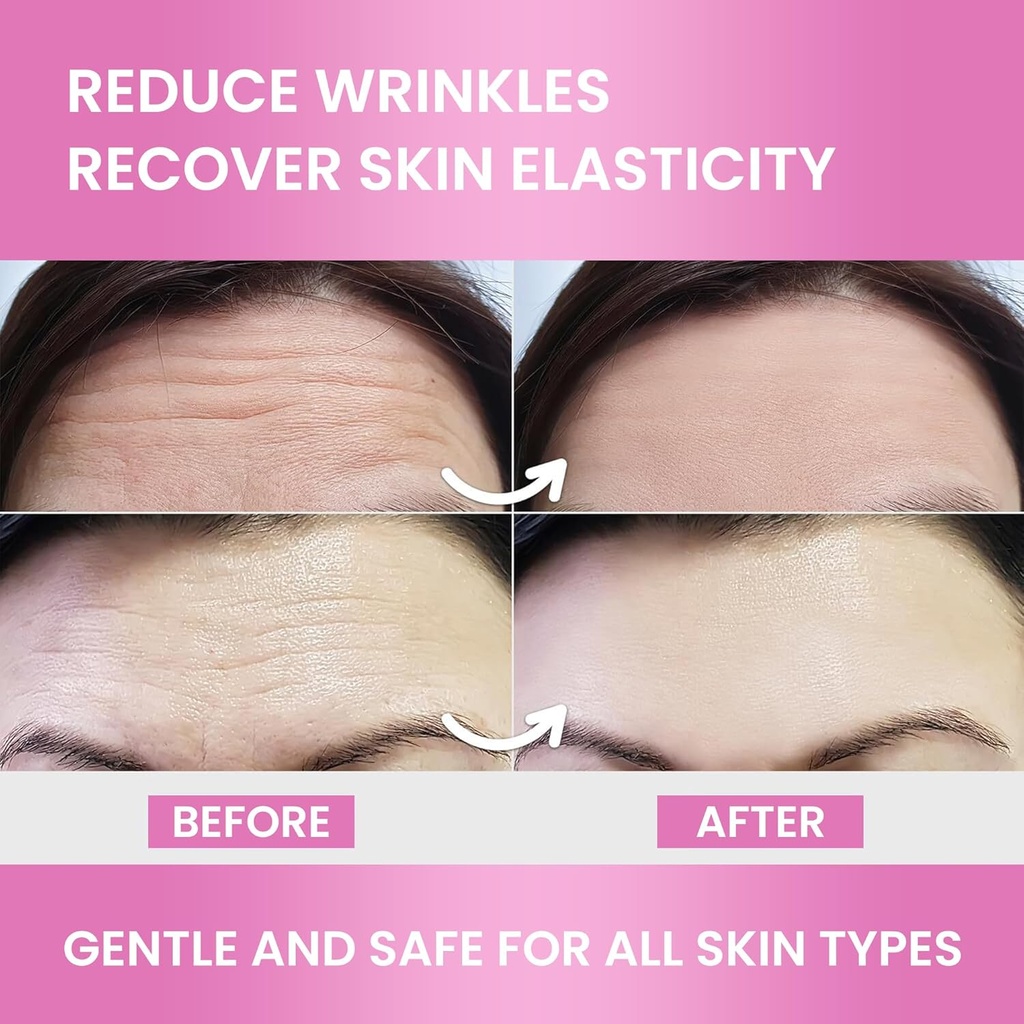 forehead-wrinkle-patches-smoothing-overn-6.jpg