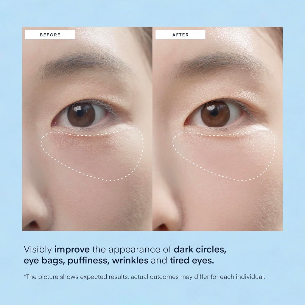terez-honor-under-eye-patches-for-dark-c-4.jpg
