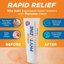 anti-fungal-cream-for-skin-with-1-tolnaf-3.jpg