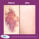 miracle-plus-arnica-cream-bruise-relief--6.jpg