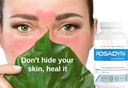 rosacea-skin-care-supplement-for-redness-5.jpg