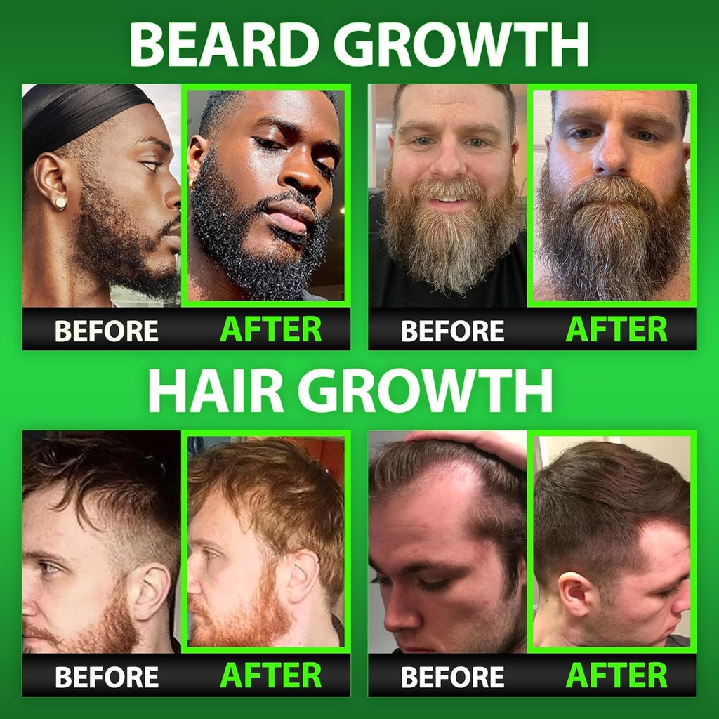 beard-growth-kit-w-620000mcg-14-in-1-bio-4.jpg