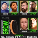 beard-growth-kit-w-620000mcg-14-in-1-bio-6.jpg