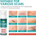 silicone-scar-gel-for-skin-scars-scar-re-4.jpg