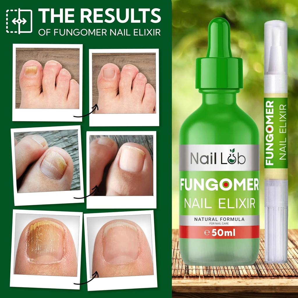 toenail-fungus-treatment-extra-strength--4.jpg