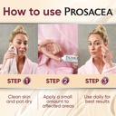 prosacea---medicated-rosacea-treatment-f-6.jpg