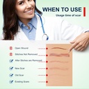 silicone-scar-sheets-clear-silicon-gel-s-4.jpg