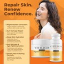 dermawonder-vitiligo-supplement-pigmenta-3.jpg