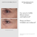 murad-retinal-resculpt-eye-lift-treatmen-3.jpg