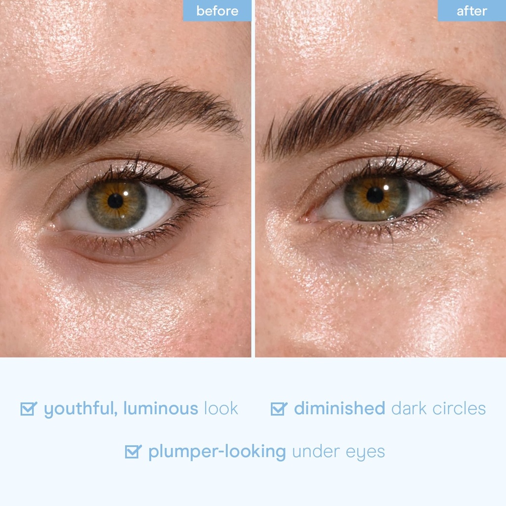 baebody-advanced-snail-mucin-under-eye-p-5.jpg