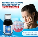 gengigel-hyaluronic-acid-mouthrinse-300--2.jpg