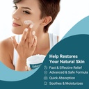 seborrheic-dermatitis-cream-extra-streng-5.jpg