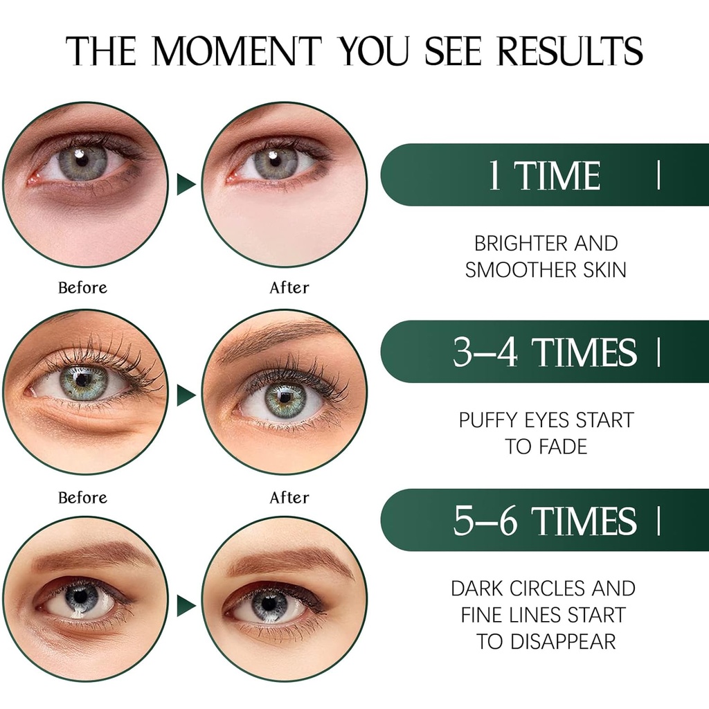 tiepetly-under-eye-masks-with-collagen-g-3.jpg