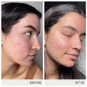 jane-iredale-skin-accumax-nutritional-su-5.jpg