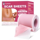 Silicone Scar Sheets,Silicone Scar Tape för kirurgiska Scars,C-Section,Tummy Tuck, Kelod Bump Removal, Face Tape för rynkor över natten (1,6 "X 59" Roll-1,5M-Pigment Reduction-Pink)