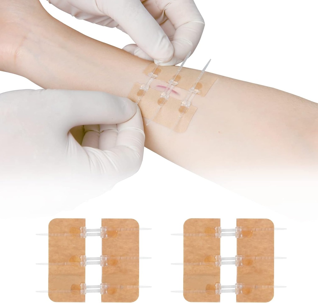 Zip Stitch Laceration Repair Utan Stitches Butterfly Bandaids Snabb Clot - Nödsårsslutning Device 2 Pieces (PU)