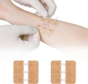 Zip Stitch Laceration Repair Utan Stitches Butterfly Bandaids Snabb Clot - Nödsårsslutning Device 2 Pieces (PU)