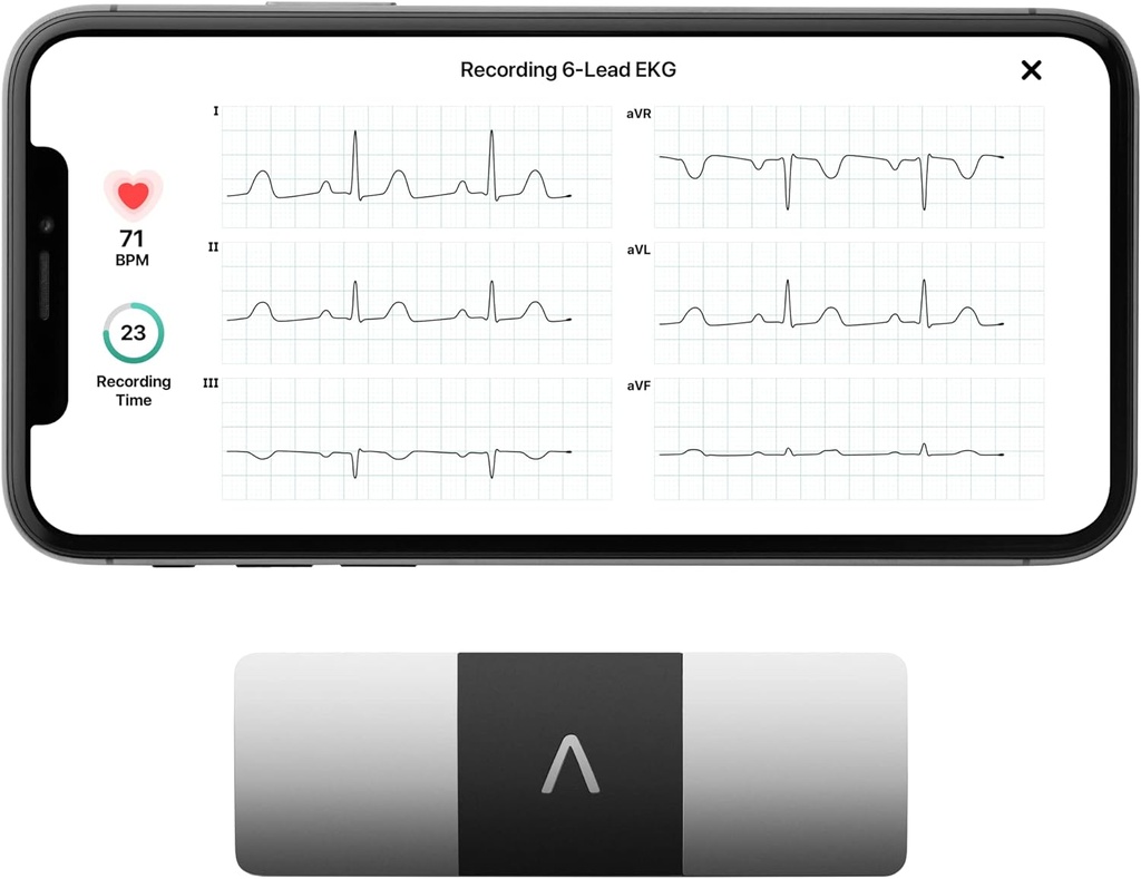 AliveCor KardiaMobile 6-Lead Personal EKG Monitor - Sex vyer av hjärtat - upptäcker AFib och oregelbundna Arrhythmias - Instant Results på 30 sekunder - arbetar med de flesta smartphones
