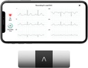 AliveCor KardiaMobile 6-Lead Personal EKG Monitor - Sex vyer av hjärtat - upptäcker AFib och oregelbundna Arrhythmias - Instant Results på 30 sekunder - arbetar med de flesta smartphones