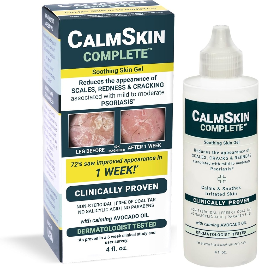 Xenna CalmSkin Complete | Clinically Proven to Soothe Irritated Skin and Improve The Appearance of Skin with Mild to Moderate Psoriasis | Made in The USA | 4 fl. oz.