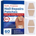 Fungal Nail Patches 60 Pcs,Upgraded Toe Nail Fungus Treatments | Nail Fungus Treatment Extra Strength,Toenail Fungus Treatment with Hydrogel for Overnight Repair Nail Fungus Patches